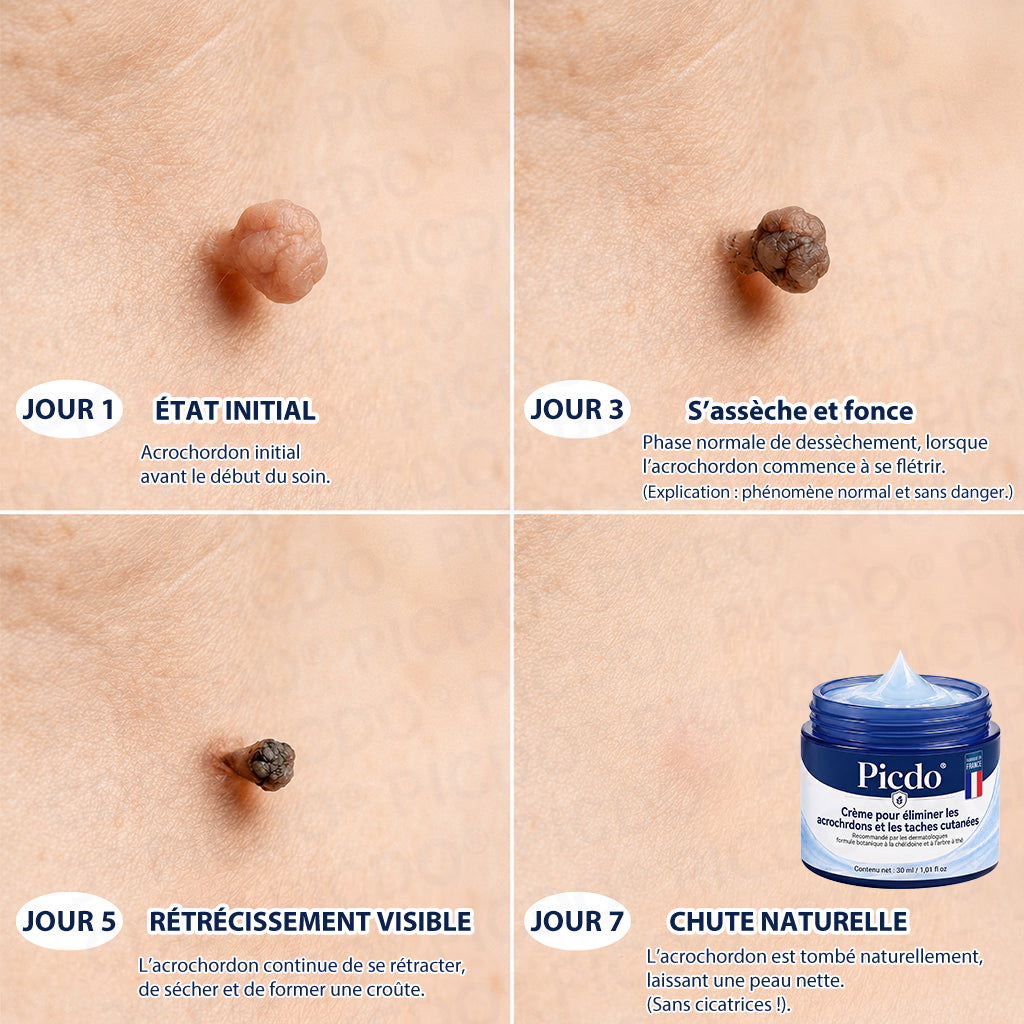𝐏i𝐜𝐝o® – Félicitations ! Vous êtes notre grand gagnant 🎁 Vous bénéficiez de 50 % de réduction sur votre commande, soit la moitié du prix. Profitez de cette offre pour vous faire plaisir à moindre coût. Offre limitée dans le temps ✨
