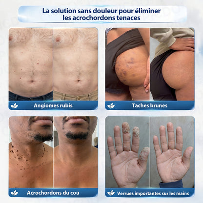 𝐏i𝐜𝐝o® – Félicitations ! Vous êtes notre grand gagnant 🎁 Vous bénéficiez de 50 % de réduction sur votre commande, soit la moitié du prix. Profitez de cette offre pour vous faire plaisir à moindre coût. Offre limitée dans le temps ✨
