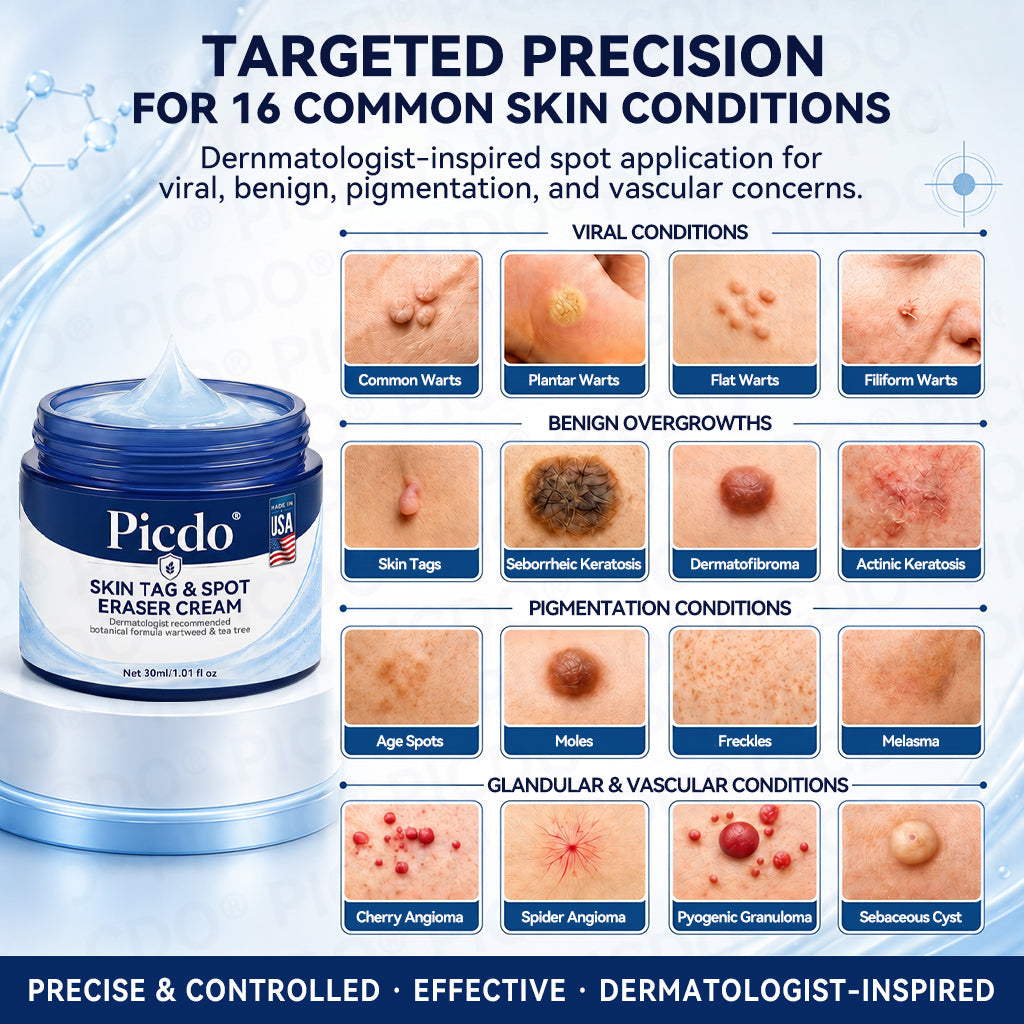 𝐏𝐢𝐜𝐝𝐨®𝐂𝐫è𝐦𝐞 𝐄𝐟𝐟𝐚𝐜𝐞𝐮𝐫 𝐝’𝐀𝐜𝐫𝐨𝐜𝐡𝐨𝐫𝐝𝐨𝐧𝐬 & 𝐝𝐞 𝐓𝐚𝐜𝐡𝐞𝐬 – 𝟕 𝐉𝐨𝐮𝐫𝐬 (𝐅𝐨𝐫𝐦𝐮𝐥𝐞 𝐙é𝐫𝐨 𝐃𝐨𝐮𝐥𝐞𝐮𝐫, 𝐙é𝐫𝐨 𝐂𝐢𝐜𝐚𝐭𝐫𝐢𝐜𝐞) 🌹