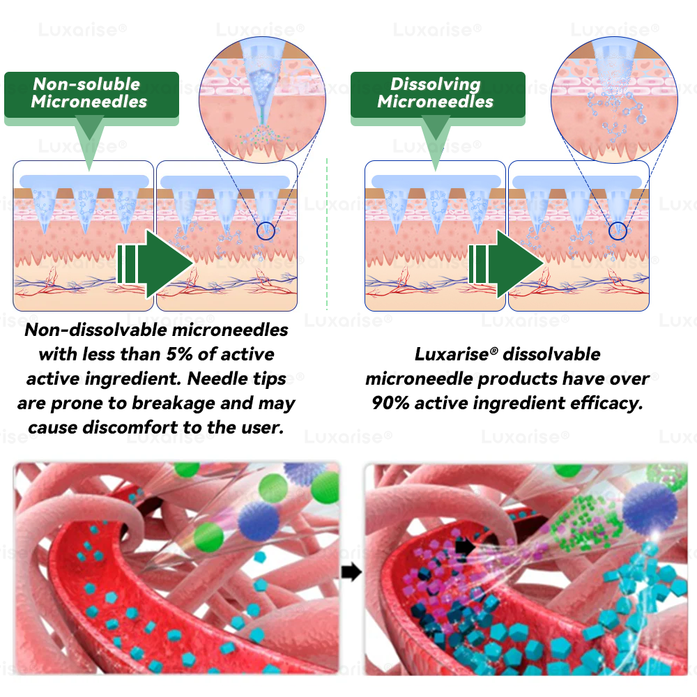 Magasin Officiel | 👩‍⚕️ Luxarise® Moringa & Berberine 10-en-1 Patch Avancé Nano Microneedle (Une application quotidienne, résultats visibles en 7 jours) ✅ Obésité, Diabète, Apnée du sommeil, Problèmes articulaires