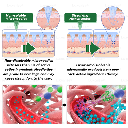 Magasin Officiel | 👩‍⚕️ Luxarise® Moringa & Berberine 10-en-1 Patch Avancé Nano Microneedle (Une application quotidienne, résultats visibles en 7 jours) ✅ Obésité, Diabète, Apnée du sommeil, Problèmes articulaires