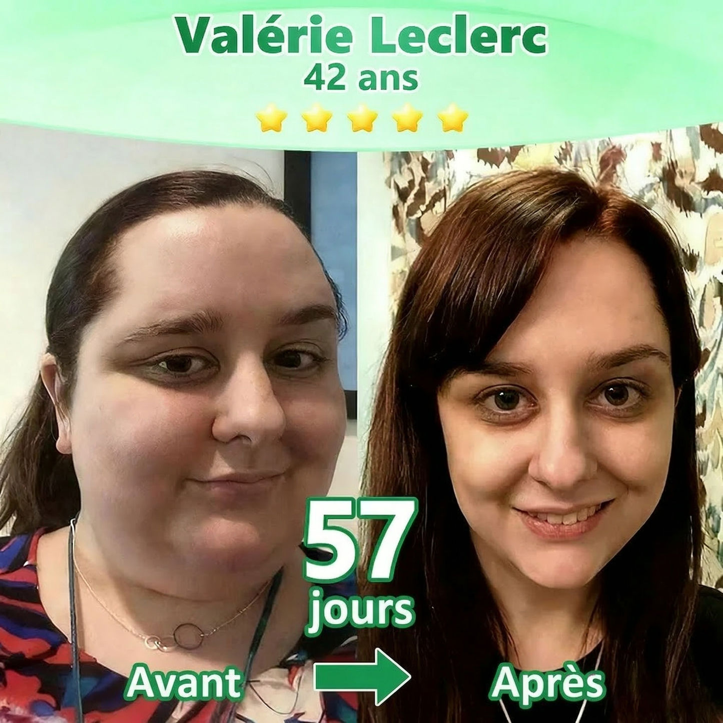 Magasin Officiel |  Luxarise® Moringa & Bérbérine 10-en-1 Patch Nanomicro-aiguilles Avancé👩‍⚕️ (Une application quotidienne, résultats visibles en 7 jours)🏆 Obésité, Diabète, Apnée du sommeil, Problèmes articulaires