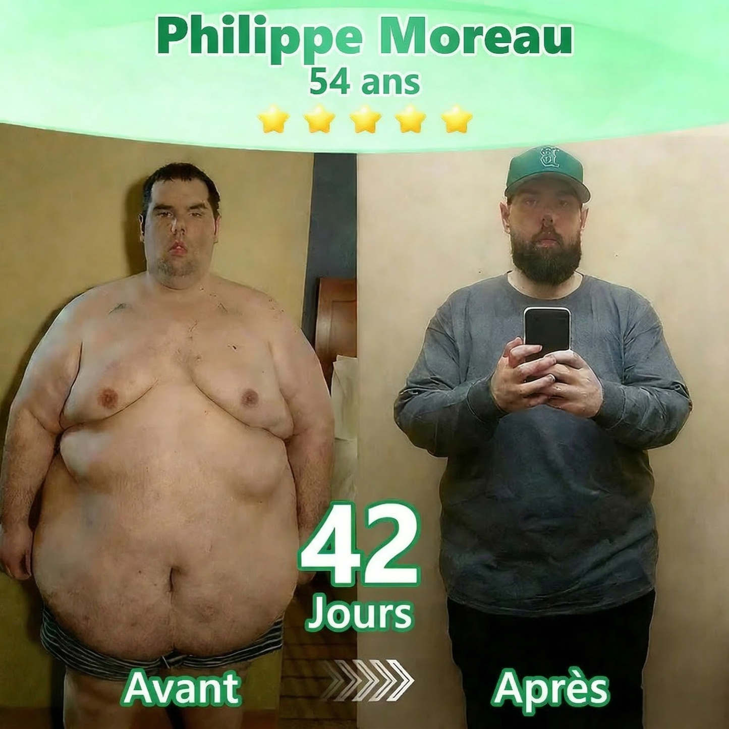 Magasin Officiel |  Luxarise® Moringa & Bérbérine 10-en-1 Patch Nanomicro-aiguilles Avancé👩‍⚕️ (Une application quotidienne, résultats visibles en 7 jours)🏆 Obésité, Diabète, Apnée du sommeil, Problèmes articulaires