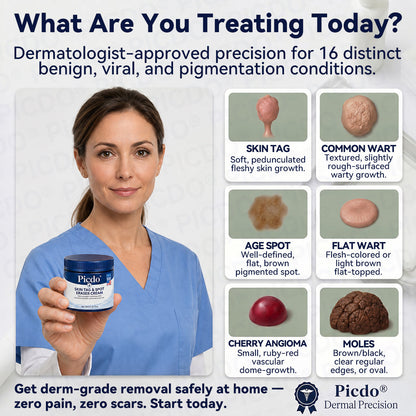 𝐏𝐢𝐜𝐝𝐨®𝐂𝐫è𝐦𝐞 𝐄𝐟𝐟𝐚𝐜𝐞𝐮𝐫 𝐝’𝐀𝐜𝐫𝐨𝐜𝐡𝐨𝐫𝐝𝐨𝐧𝐬 & 𝐝𝐞 𝐓𝐚𝐜𝐡𝐞𝐬 – 𝟕 𝐉𝐨𝐮𝐫𝐬 (𝐅𝐨𝐫𝐦𝐮𝐥𝐞 𝐙é𝐫𝐨 𝐃𝐨𝐮𝐥𝐞𝐮𝐫, 𝐙é𝐫𝐨 𝐂𝐢𝐜𝐚𝐭𝐫𝐢𝐜𝐞) 🌹