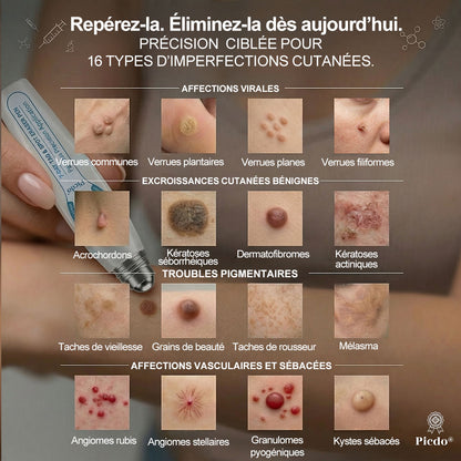 Boutique officielle de la marque |🔥𝐏i𝐜𝐝o® 7 Jours Effaceur de taches et d’excroissances cutanées(Zéro douleur, zéro cicatrice – Roller)💎