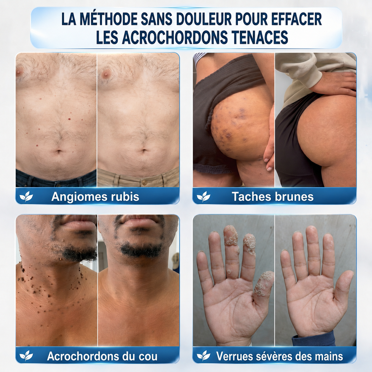 𝐵o𝑢𝑡𝑖𝑞𝑢𝑒 O𝑓𝑓𝑖𝑐𝑖𝑒𝑙𝑙𝑒✅𝑵𝒆𝒌𝒊𝒔𝒔®🚀𝑴𝒊𝐜𝐫𝐨𝒏𝐞𝐞𝒅𝒍𝒆𝒔 𝑷𝒆𝒂𝒖 𝑷𝒂𝒓𝒇𝒂𝒊𝒕𝒆 É𝒍𝒊𝒎𝒊𝒏𝒂𝒕𝒊𝒐𝒏 𝑫𝒆𝒔 𝑽𝒆𝒓𝒓𝒖𝒆𝒔 𝑷𝒂𝒕𝒄𝒉 (𝑃𝑜𝑢𝑟 𝑙𝑒𝑠 𝑎𝑐𝑟𝑜𝑐ℎ𝑜𝑟𝑑𝑜𝑛𝑠, 𝑙𝑒𝑠 𝑝𝑒𝑡𝑖𝑡𝑒𝑠 𝑒𝑥𝑐𝑟𝑜𝑖𝑠𝑠𝑎𝑛𝑐𝑒𝑠 𝑐𝑢𝑡𝑎𝑛é𝑒𝑠, 𝑙𝑒𝑠 𝑣𝑒𝑟𝑟𝑢𝑒𝑠, 𝑙𝑒𝑠 𝑔𝑟𝑎𝑖𝑛𝑠 𝑑𝑒 𝑏𝑒𝑎𝑢𝑡é, 𝑙𝑒𝑠 𝑡𝑎𝑐ℎ𝑒𝑠 𝑑𝑒 𝑣𝑖𝑒𝑖𝑙𝑙𝑒𝑠𝑠𝑒 𝑒𝑡 𝑙𝑒𝑠 𝑝𝑟𝑜𝑏𝑙è𝑚𝑒𝑠 𝑑𝑒 𝑝𝑖𝑔𝑚𝑒𝑛𝑡𝑎𝑡𝑖𝑜𝑛)